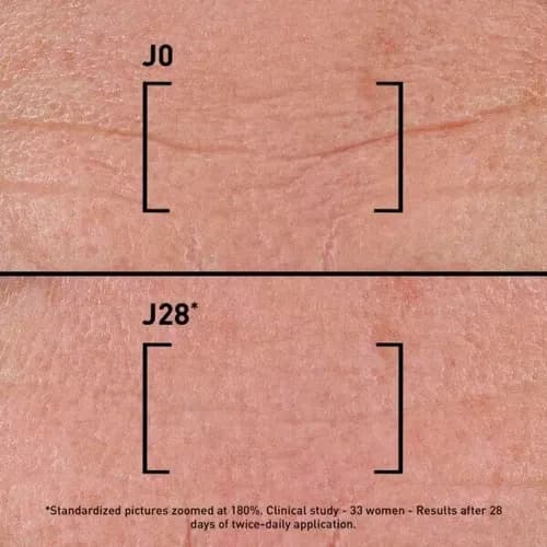 FILORGA TIME-FILLER INTENSIVE 5XP thumbnail 2